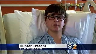 Shark Attack Victim Recalls Terrifying Run-In