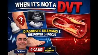 DVT Mimics and Diagnostic Dilemmas: Four Clinical Case Discussions