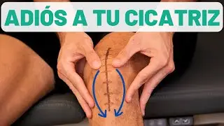 КАК УДАЛИТЬ ШРАМЫ? ⚡ ДОМА с 1 МАССАЖЕМ