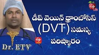 Deep Vein Thrombosis (Dvt) Problem | Dr.ETV | 8th Aug 2022 | ETV Life