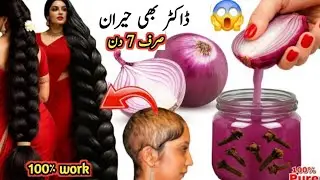 How to Use Onion For 10x Faster Thicker Hair Growth!!😍