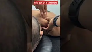 Trapes muscle trigger point release #physiotherapist #dryneedling #maniralam #jointpain #viralreels