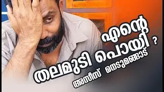 Azees Nedumangad Hair Issue