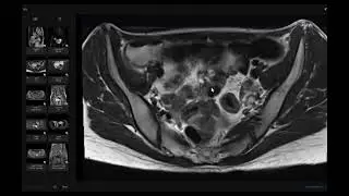 Гинекология Viva/Oral/Long Cases