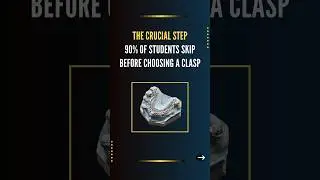 The crucial step 90% of students skip before choosing a clasp&nbsp;| Removable Partial Dentures&nbsp;#shorts