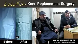 Successful Both Knee Replacement Surgery Using MIS Technique  Lahore, Pakistan
