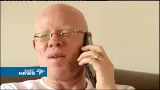 Albinism awareness spreads across the country