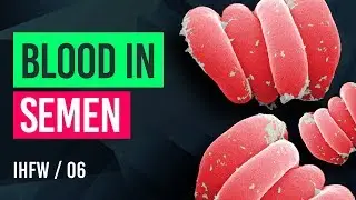 BLOOD IN SEMEN | HEMATOSPERMIA