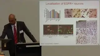 Prof Suresh Sundram - Evidence for biomarker development in schizophrenia sub-groups