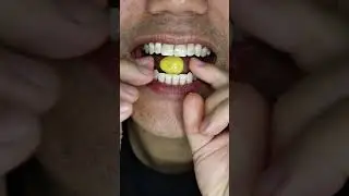 ASMR | Chocolate Egg Treat 🍫 #DoctorTristanPeh #ASMR