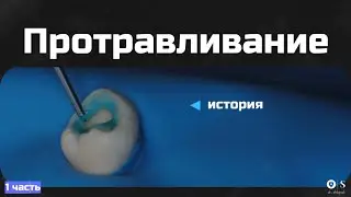 Протравливание (1 часть)