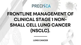 Expert Cancer Panel: Front-line management of clinical stage I NSCLC