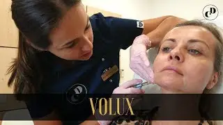 Modelowanie żuchwy i brody – Derma Clinique