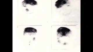 Melaton - Moonstorm (Original E.P. Version)