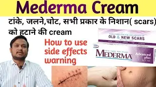 Mederma cream | mederma for acne scars | mederma advanced scar gel review