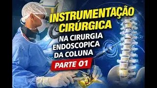 Instrumenta&ccedil;&atilde;o Cir&uacute;rgica | Cirurgia Endosc&oacute;pica da Coluna &ndash; Parte 01