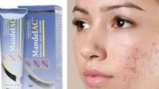 Jenpharm mandelac face wash👎...My review on jenpharm face wash..
