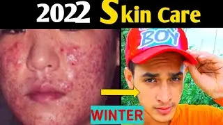Follow this -*BEST* WINTER SKIN CARE ROUTINE | Winter SKIN CARE tips MEN | Stylish Nuran