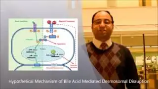 Digestive Disease Week 2017- Video Abstract