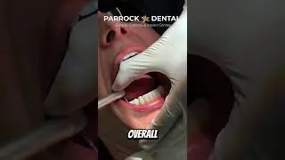 Full-Mouth Dental Implant Testimonial | Zirconia Upgrade
