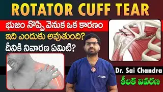 రోటేటర్ కఫ్ టియర్ అంటే ఏమిటి? కారణాలు, చికిత్సలు | Dr. Sai Chandra | Shoulder Pain Explained