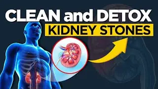 Clean & Detox Your Kidneys | Foods That Prevent Kidney Stones Naturally After 40