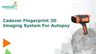 Cadaver Fingerprint 3D imaging system for autopsy