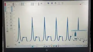 Example of a Bad In Cylinder Pressure Waveform (2014 Honda Pilot Lack of Power-Backpressure)