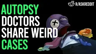 Autopsy Doctors Share Weird Cases (r/Askreddit)