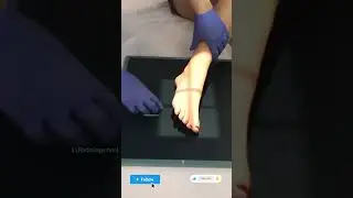 Foot Oblique X-ray image #xray #xraytechnician #trending #viralvideo
