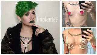 Why I Got Plastic Surgery (+Am I Talking Different?) | HeyThereImShannon