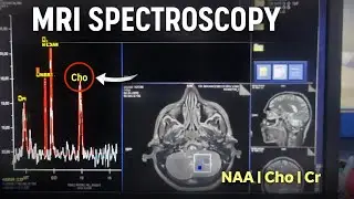MRI Spectroscopy Filming 