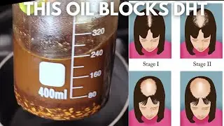 DIY DHT Blocking Hair Oil to fight Androgenic Alopecia |Week 8 Prevent Hair Loss