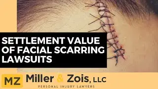 Settlement Value of Facial Scarring Lawsuits