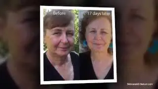 Nerium Scam | Is Nerium AD a Scam? Do not join Nerium AD until you watch this video!