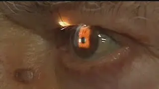 Survey says blue light is leading cause of eye strain