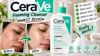 Didn't expected this!😭CeraVe Foaming Cleanser Brutally Honest ✅
