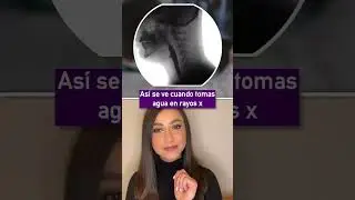 As&iacute; se ve cuando tomas agua en rayos x👩🏻&zwj;⚕️ #SabiasQue #interesante #RayosX #DatoCurioso #shorts
