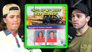 Dayton Prices Full Story Of His Horrific Accident