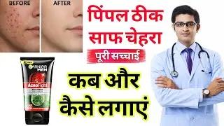 Garnier men acno fight face wash review 2026 in hindi 