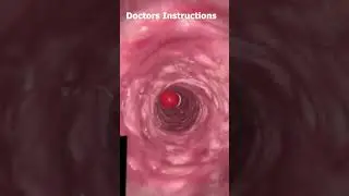 How To CAPSULE 💊 Metabolize in Stomach💊🩸 #animation #1million #3d