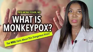 What IS Monkeypox? [The REAL facts about this dangerous virus]