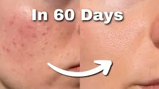 10 Skincare Habits That Will Transform Your Face Completely | Korean Edition