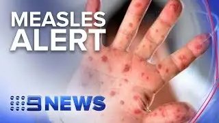 Outbreak of highly infectious disease| Nine News Australia