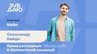 Кейс прямої реставрації бічних зубів в біоміметичній концепції