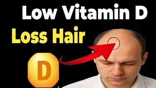  Vitamin D and Hair Loss: What Science and Doctors Really Say