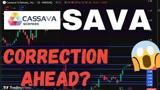 SAVA Stock (Cassava Sciences) SAVA STOCK PREDICTIONS SAVA STOCK Analysis SAVA stock news today