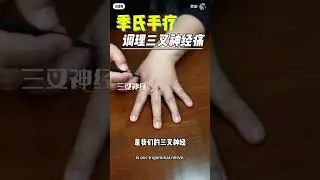 季氏手诊手疗三叉神经痛 #中医 #中國醫 #中医文化 #三叉神经痛