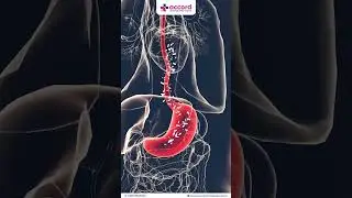 Why Is Fasting Before Surgery So Important? | Dr. Asif Umar