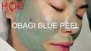 OBAGI BLUE PEEL TREATMENT
